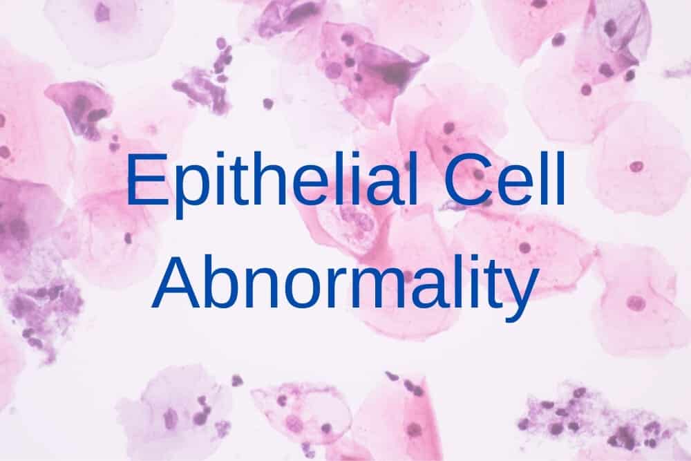 Epithelial Cell Abnormality: All You Need To Know