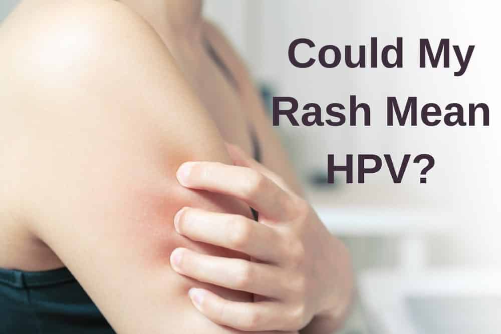 Could your rash be a symptom of HPV?